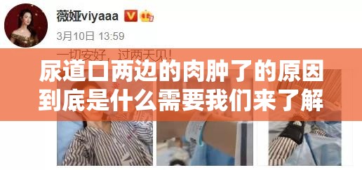 尿道口两边的肉肿了的原因到底是什么需要我们来了解