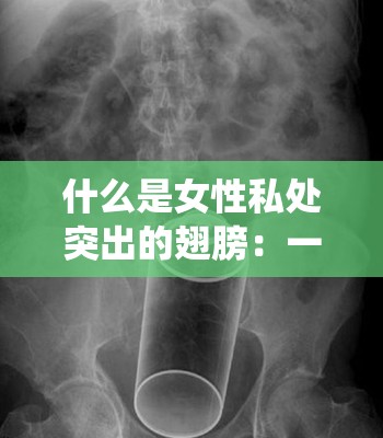 什么是女性私处突出的翅膀：一种罕见的女性生殖系统畸形