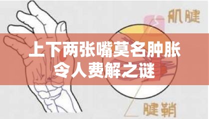 上下两张嘴莫名肿胀令人费解之谜